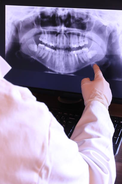Best Emergency Dentist for Knocked-Out Tooth in Milam, TX