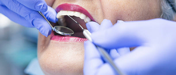 Best Broken or Cracked Tooth Emergency Dentist in Milam, TX